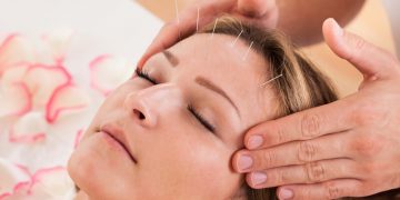 What Role Does Acupuncture Play in Physiotherapy?